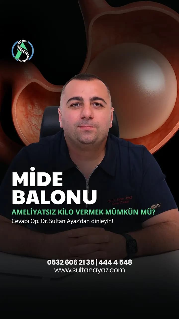 Mide balonu nasıl uygulanır?